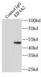 Eukaryotic Translation Initiation Factor 4A2 antibody, FNab02717, FineTest, Immunoprecipitation image 