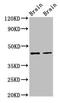 Mitogen-activated protein kinase 3 antibody, LS-C317941, Lifespan Biosciences, Western Blot image 