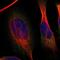 Sterile Alpha Motif Domain Containing 4B antibody, PA5-53490, Invitrogen Antibodies, Immunofluorescence image 