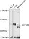 Centrosomal Protein 120 antibody, 23-344, ProSci, Western Blot image 