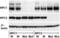 NPC Intracellular Cholesterol Transporter 1 antibody, NB400-148, Novus Biologicals, Western Blot image 