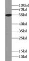 ZFP2 Zinc Finger Protein antibody, FNab09622, FineTest, Western Blot image 