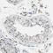 Ectonucleoside Triphosphate Diphosphohydrolase 4 antibody, HPA017655, Atlas Antibodies, Immunohistochemistry frozen image 
