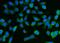 Decapping MRNA 1A antibody, A04587-2, Boster Biological Technology, Immunofluorescence image 