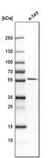 Calcium uptake protein 1, mitochondrial antibody, PA5-57966, Invitrogen Antibodies, Western Blot image 