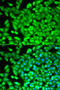 FBP antibody, A01377, Boster Biological Technology, Immunofluorescence image 