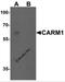 Histone-arginine methyltransferase CARM1 antibody, 7219, ProSci Inc, Western Blot image 