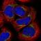 Armadillo Repeat Containing 1 antibody, NBP1-88847, Novus Biologicals, Immunofluorescence image 