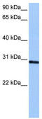 Ankyrin Repeat And SOCS Box Containing 11 antibody, TA339958, Origene, Western Blot image 