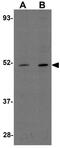 Coiled-Coil Domain Containing 47 antibody, GTX31977, GeneTex, Western Blot image 