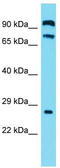Chromosome 2 Open Reading Frame 70 antibody, TA334860, Origene, Western Blot image 