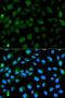 Promyelocytic Leukemia antibody, LS-B13361, Lifespan Biosciences, Immunofluorescence image 