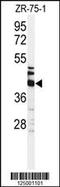 Keratin 35 antibody, 61-746, ProSci, Western Blot image 