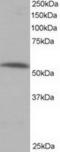 Serine/threonine-protein phosphatase 2A 56 kDa regulatory subunit alpha isoform antibody, TA302741, Origene, Western Blot image 