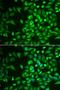 Lecithin Retinol Acyltransferase antibody, LS-C334848, Lifespan Biosciences, Immunofluorescence image 