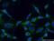 Rac Family Small GTPase 1 antibody, 66122-1-Ig, Proteintech Group, Immunofluorescence image 