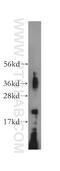 Mitochondrial import inner membrane translocase subunit Tim17-A antibody, 11189-1-AP, Proteintech Group, Western Blot image 