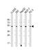Putative elongation factor 1-alpha-like 3 antibody, PA5-72339, Invitrogen Antibodies, Western Blot image 