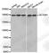 Histone-lysine N-methyltransferase SETDB1 antibody, A1005, ABclonal Technology, Western Blot image 