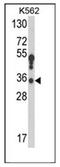 Hydroxysteroid 17-Beta Dehydrogenase 3 antibody, AP52111PU-N, Origene, Western Blot image 
