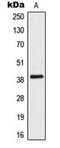 N(Alpha)-Acetyltransferase 50, NatE Catalytic Subunit antibody, orb341290, Biorbyt, Western Blot image 