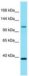 Epidermal Growth Factor Receptor Pathway Substrate 15 Like 1 antibody, TA332003, Origene, Western Blot image 