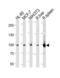 Signal Transducer And Activator Of Transcription 5B antibody, TA324586, Origene, Western Blot image 