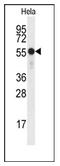 Checkpoint Kinase 1 antibody, AP12111PU-N, Origene, Western Blot image 