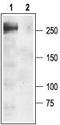 Sodium channel protein type 1 subunit alpha antibody, TA329027, Origene, Western Blot image 