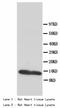 Fatty Acid Binding Protein 3 antibody, LS-C172162, Lifespan Biosciences, Western Blot image 