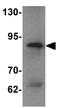 Enhancer Of Zeste 2 Polycomb Repressive Complex 2 Subunit antibody, GTX31435, GeneTex, Western Blot image 