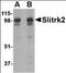 SLIT And NTRK Like Family Member 2 antibody, orb88748, Biorbyt, Western Blot image 