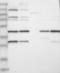 La Ribonucleoprotein Domain Family Member 1B antibody, NBP1-84184, Novus Biologicals, Western Blot image 