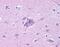 Neuropeptide Y Receptor Y5 antibody, NLS1074, Novus Biologicals, Immunohistochemistry paraffin image 