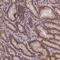 Coiled-Coil Domain Containing 9B antibody, NBP1-93763, Novus Biologicals, Immunohistochemistry paraffin image 