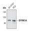 Dual specificity tyrosine-phosphorylation-regulated kinase 1A antibody, PA5-17240, Invitrogen Antibodies, Western Blot image 