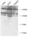 Protein timeless homolog antibody, FNab10381, FineTest, Western Blot image 