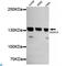 Histone Deacetylase 4 antibody, LS-C812989, Lifespan Biosciences, Western Blot image 
