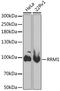 Ribonucleotide Reductase Catalytic Subunit M1 antibody, 15-129, ProSci, Western Blot image 