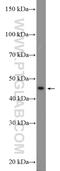 Vascular endothelial growth factor A antibody, 22341-1-AP, Proteintech Group, Western Blot image 