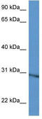 Ribosomal Protein L5 antibody, TA335158, Origene, Western Blot image 