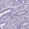  antibody, HPA023322, Atlas Antibodies, Immunohistochemistry paraffin image 