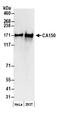 Transcription Elongation Regulator 1 antibody, A300-360A, Bethyl Labs, Western Blot image 