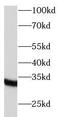 TNFRSF1A Associated Via Death Domain antibody, FNab08915, FineTest, Western Blot image 