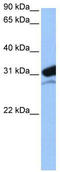 Mitochondrial Ribosomal Protein L24 antibody, TA343930, Origene, Western Blot image 