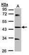 Serologically defined colon cancer antigen 3 antibody, PA5-21723, Invitrogen Antibodies, Western Blot image 