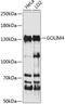 Golgi integral membrane protein 4 antibody, 15-563, ProSci, Western Blot image 