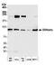 Diacylglycerol Kinase Zeta antibody, A302-967A, Bethyl Labs, Western Blot image 