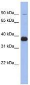 Membrane Palmitoylated Protein 3 antibody, TA337654, Origene, Western Blot image 