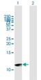 Urp antibody, H00257313-B01P, Novus Biologicals, Western Blot image 